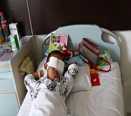 سرقة عيني طفل بعد اختطافه من أمام منزله